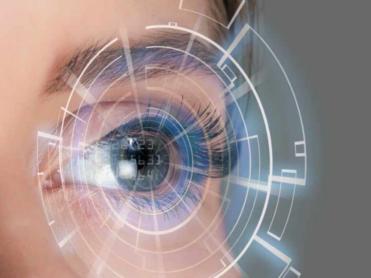 LASIK-surgery-in-Iran
