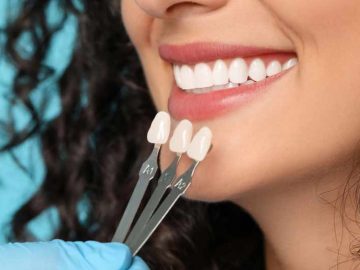 dental-implants-in-Iran