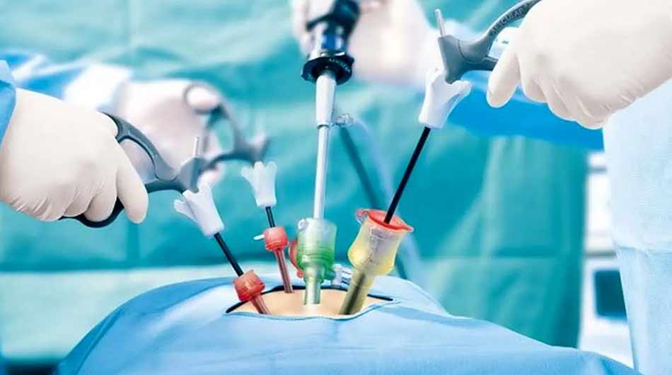 Bariatric-Surgery-in-Iran