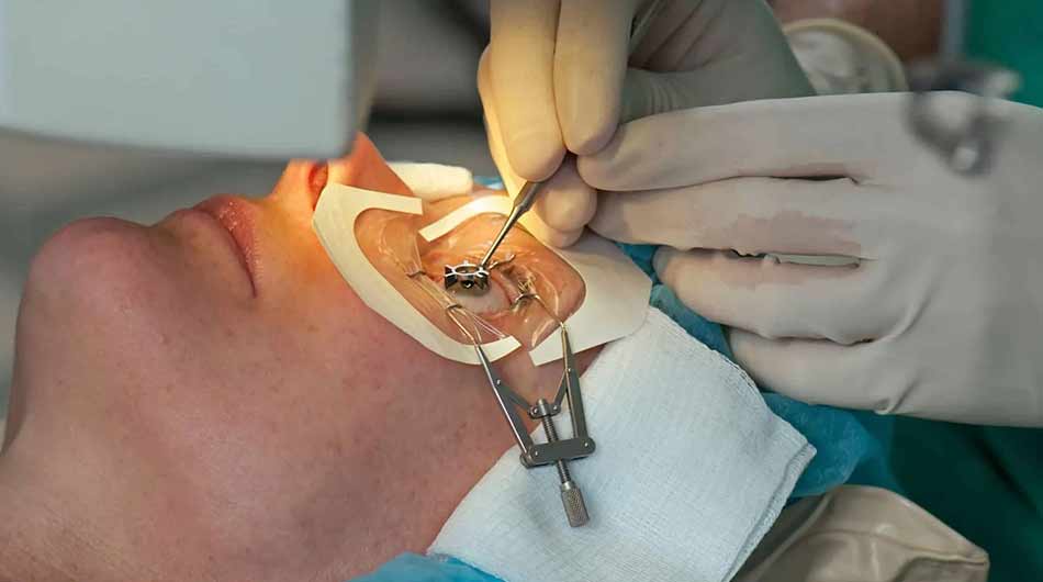 eye-clinics-in-Iran
