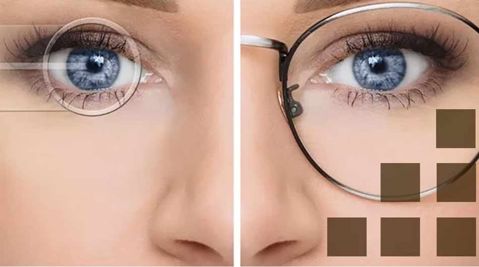 cataract-surgery-Iran