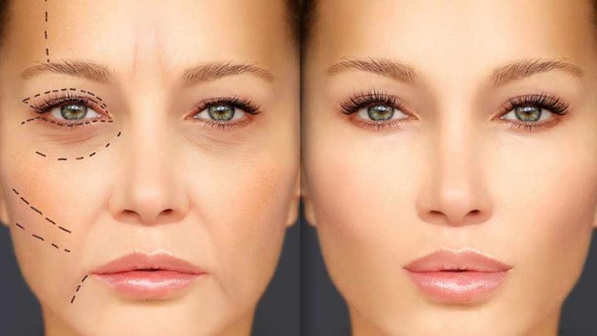 cosmetic-surgery-in-Iran