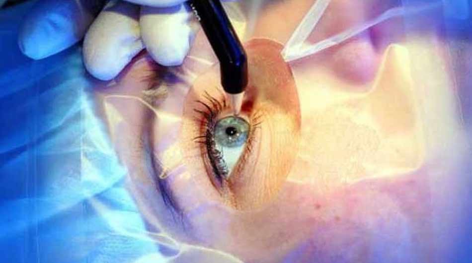 eye-surgery-in-Iran